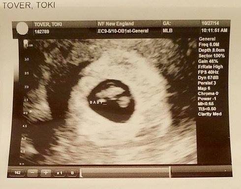 my first internal ultrasound