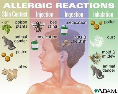 allergic reations