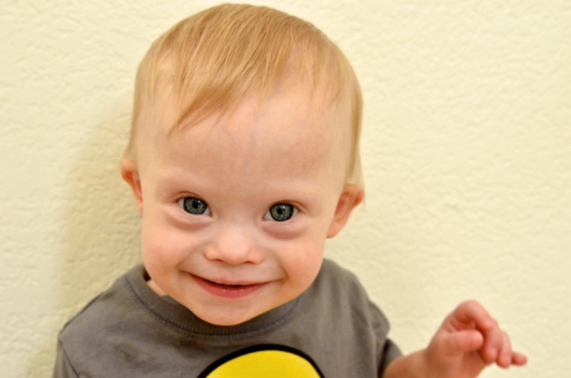 extra chromosome is so cute down syndrome